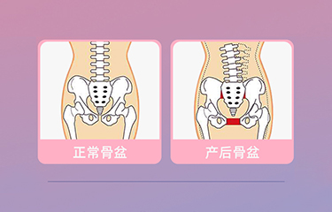 盆底肌修復(fù)儀器怎么樣？哪些人可以使用它呢